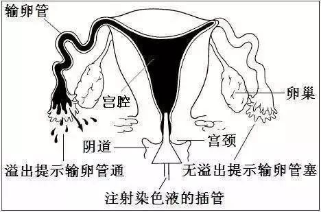 通草的功效与作用